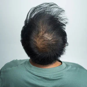 1. Choose Your Shade