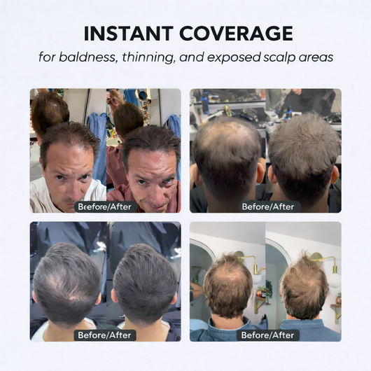 boldvik™ - Instant Hair Concealer Powder